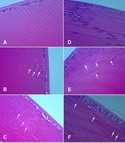 Poster & Lens HistoPathology